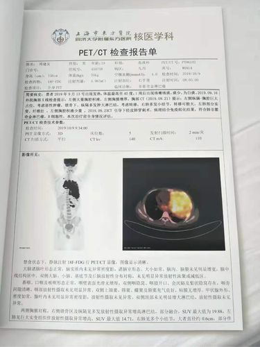 petct技师收入（petct招聘）-图1